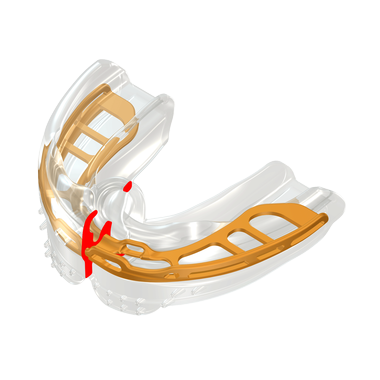 Myobrace B2 for Braces MEDIUM, čirý
