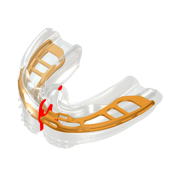 Myobrace B2 for Braces MEDIUM, čirý