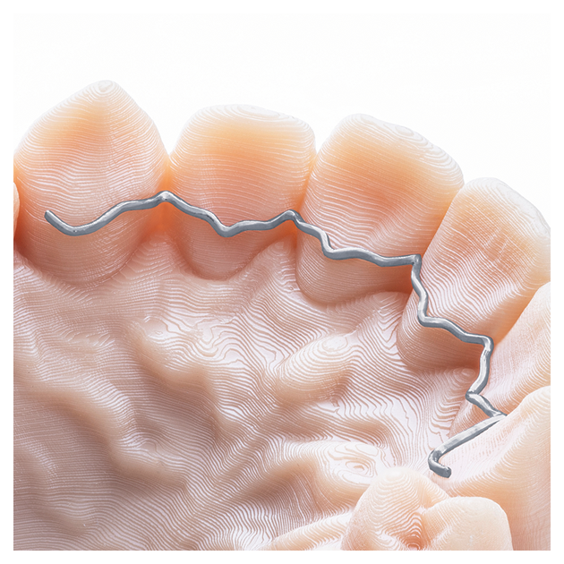 Dentaurum prime4me® RETAIN3R - 3D retainer