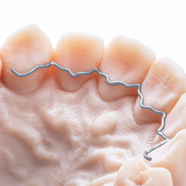 Dentaurum prime4me® RETAIN3R - 3D retainer