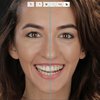 3Shape_TRIOS_3_eshop_smile_design