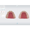 3Shape_TRIOS_3_eshop_treatment_simulator