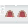 3Shape_Trios_5_Intraoralni_skener_BELdental_5