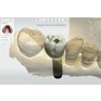 3Shape_Trios_5_Intraoralni_skener_BELdental_6