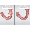 3Shape_Trios_5_Intraoralni_skener_BELdental_7