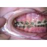 saga-dental-foto-retraktory-rozverace-small-2-ks_4720_2.jpg